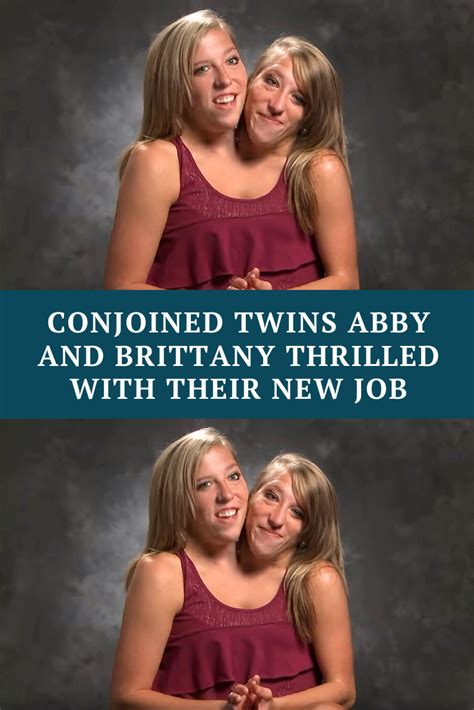 sexy conjoined twins|The Sex Lives of Conjoined Twins .